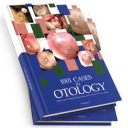 1001 cases in Otology